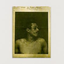 Cadavre de Garnier (a) — circa 1970
