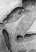 Anne : Genoux gauche - pubis - Traces