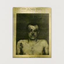 Cadavre de Vallet (b) — circa 1970