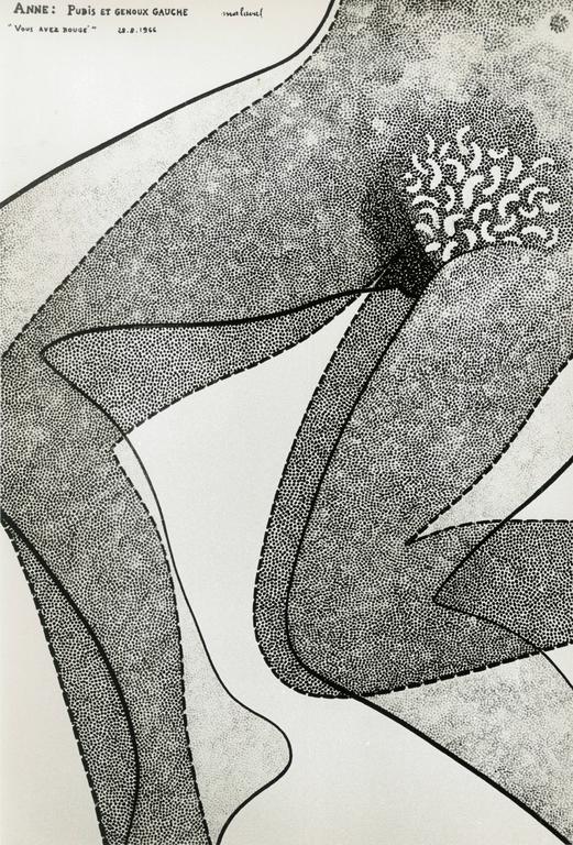 Catalogue raisonné, Robert Malaval, Anne : Pubis et genoux gauche "Vous avez bougé"