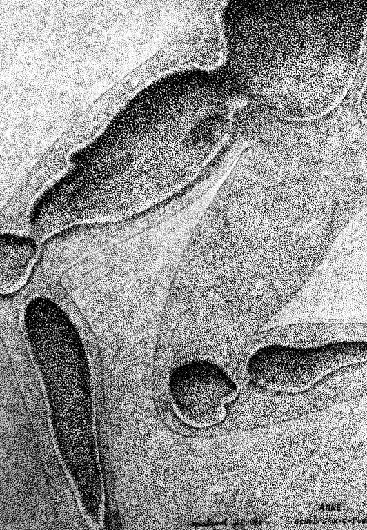 Catalogue raisonné, Robert Malaval, Anne : Genoux gauche - pubis - Traces